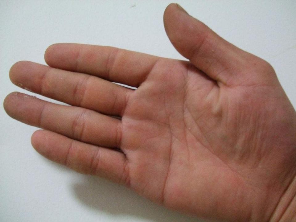 手掌圆胖掌圆指粗,手有钱财,长肉多的手,又称为"收财手",一辈子钱财来