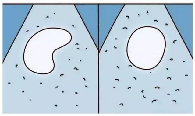 那些民间流传的胎儿性别鉴别土方法,就服第3种