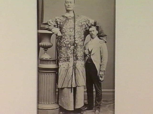 全世界最高的人,安徽长人身高3米多
