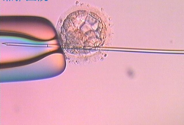 卵泡发育不好怎么办?试管婴儿能助孕成功吗?