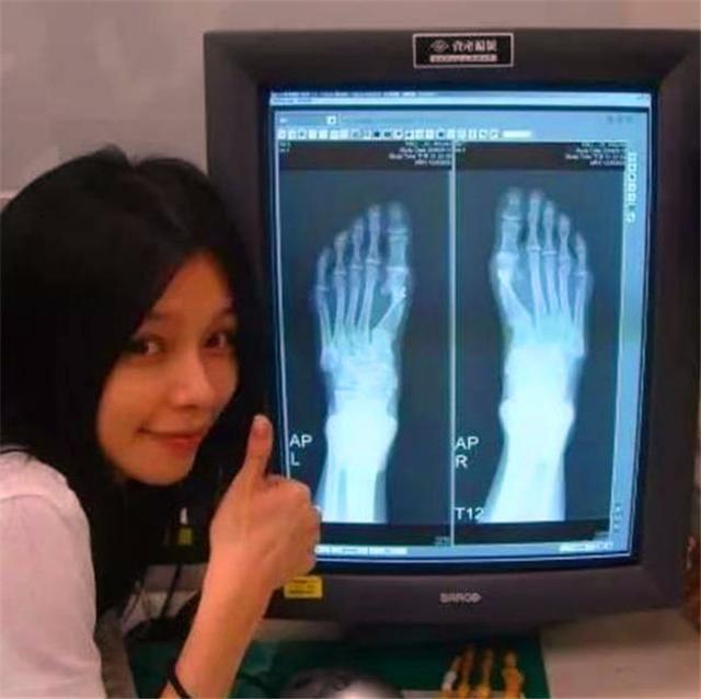 这些女明星的脚好恐怖,怎么都成这样了?