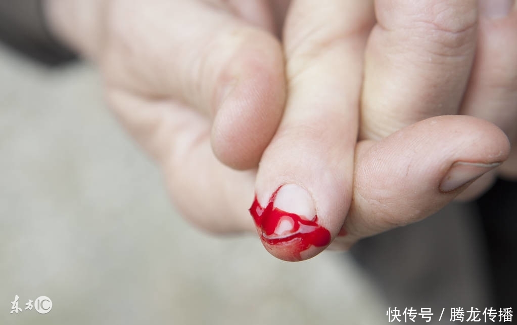 腾湃腾龙--40岁梅艳芳死于宫颈癌,女性出现这3