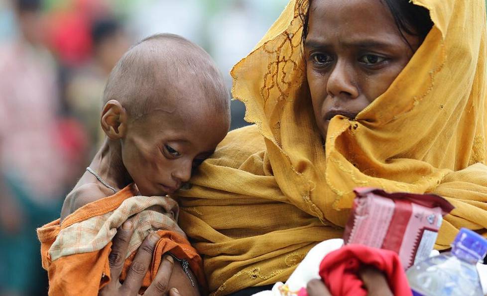 探访孟加拉难民营 儿童挨饿瘦骨嶙峋