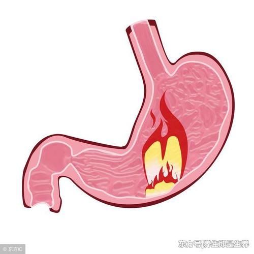 胃病3种常见类型,消化科医生:认得清治疗更精