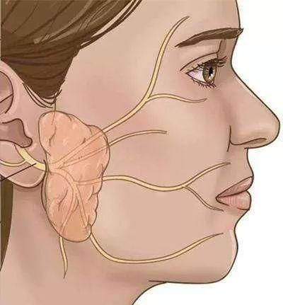 耳根前下方常见的肿物腮腺肿瘤