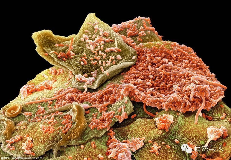 刷牙很重要!看口腔细菌在显微镜下的模样吧