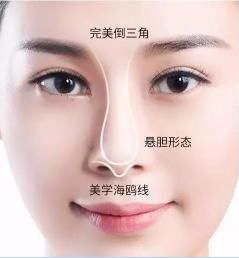 鼻翼整形:塑造完美海鸥线