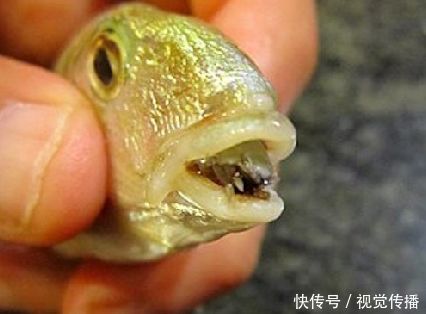 肚子痛持续6年,最终被查出原因,这东西钻入了