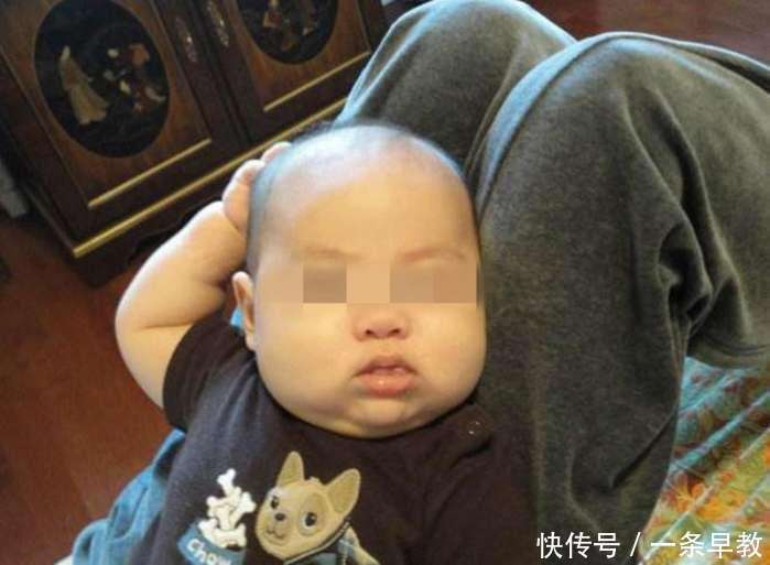 1岁宝宝总是用手摸头, 医生检查后怒斥父母不