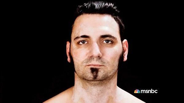 他曾是黑帮老大 因为一个理由洗掉面部文身重