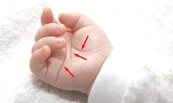 耳朵有这个特征的孩子,聪明过人可能是神童,会是你家的宝宝?