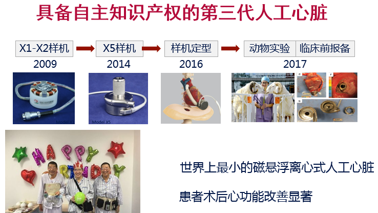 我国心血管外科新技术领跑国际 卫健委:第三代人工心脏即将临床应用 我国心血管外科新技术领跑国际 卫健委:第三代人工心脏即将临床应用