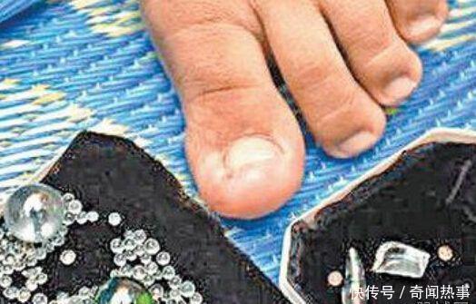 世界上十大最令人羡慕的怪病,第十种男生都想