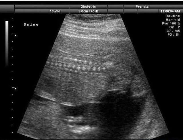 孕妈要关注胎动情况,防止胎儿宫内缺氧,好习惯