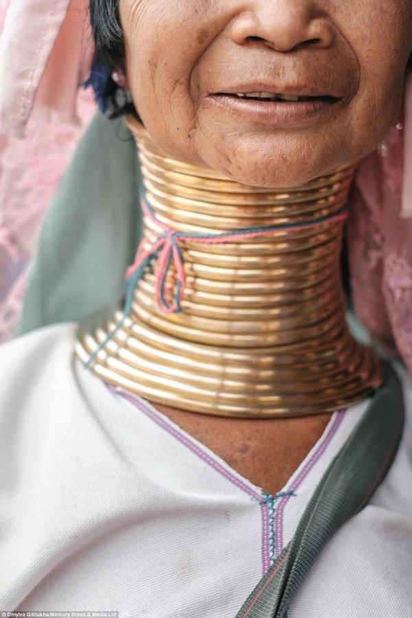 乌克兰摄影师德米特罗（Dmytro Gilitukha）拍摄了这组罕见的照片。德米特罗说：“有人说如果把铜圈拿下来，她们的脖子就断了，显然并不是这样。我看到过一个女人拿下来她的项圈，没有任何异常。铜圈拿下来之后三个星期，脖子就会恢复到正常的样子。”