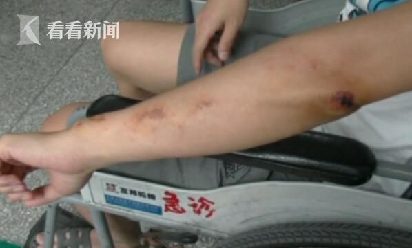 父亲怀抱9个月大婴儿被6条流浪狗