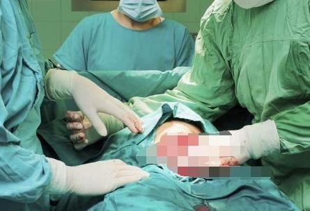 产妇分娩时大出血,医生建议摘掉子宫保命,家属