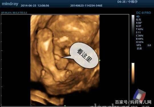 做四维看男孩女孩的诀窍,医生的暗语,要多准