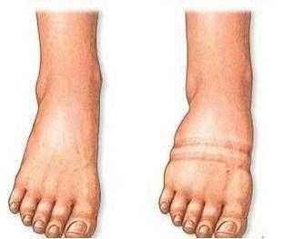 还在好奇周冬雨吴昕的小粗腿怎么突然变细?瘦