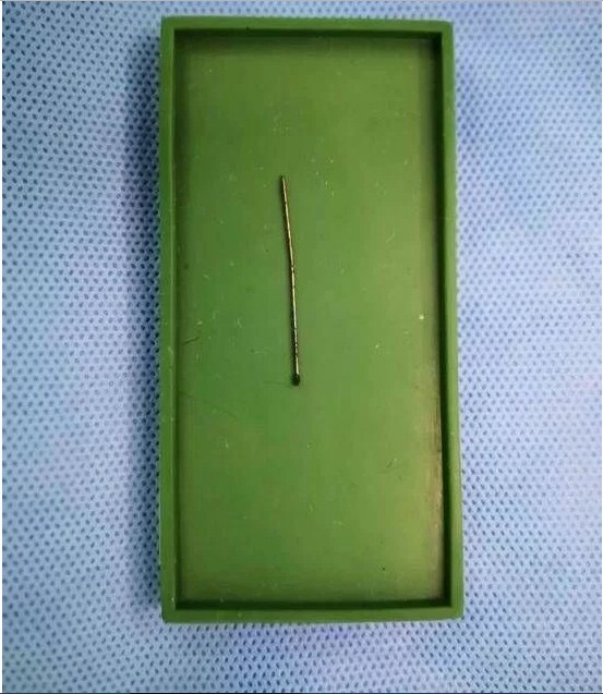 1岁女婴心脏上扎4厘米长针 原来是妈妈有这个