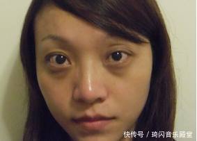 女人脸上长斑、下巴长痘别不在乎,很可能是妇