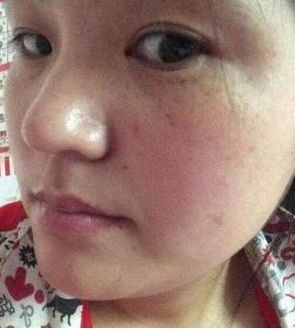 乡下大姐偶尔发现的祛斑配方,用了它肉眼都能