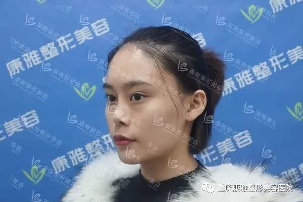 还在纠结做哪款鼻子好看?听处女座小姐姐的准