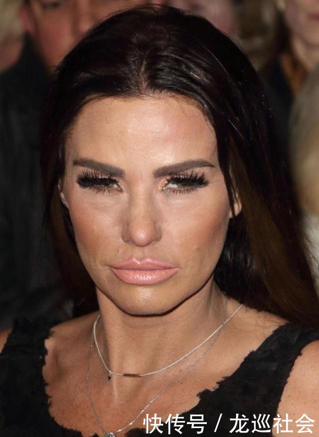 女模特整容失败变僵尸脸,从美女整容成了丑女