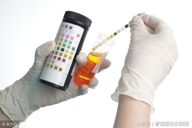 尿酸值高于700,会有什么后果?警惕这3种大病