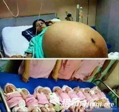 印度一女子产下十一胞胎