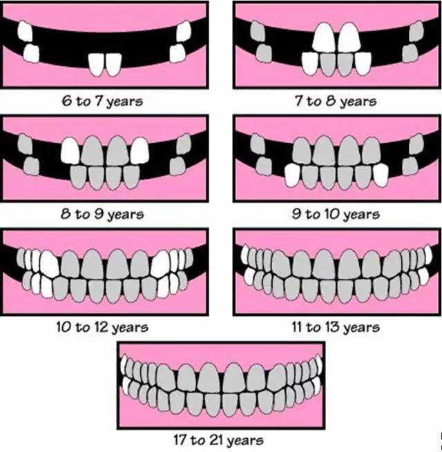 恒牙还不长?乳牙还不掉?换牙期都需要注意什么问题呢?