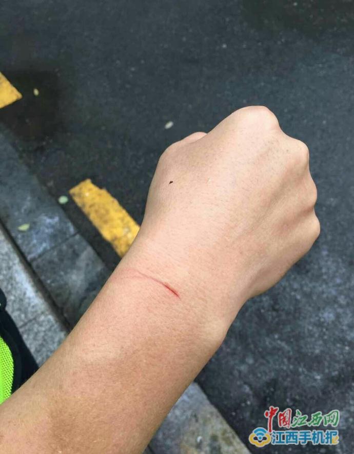 交警被单车座位下扫码铁片划破手臂