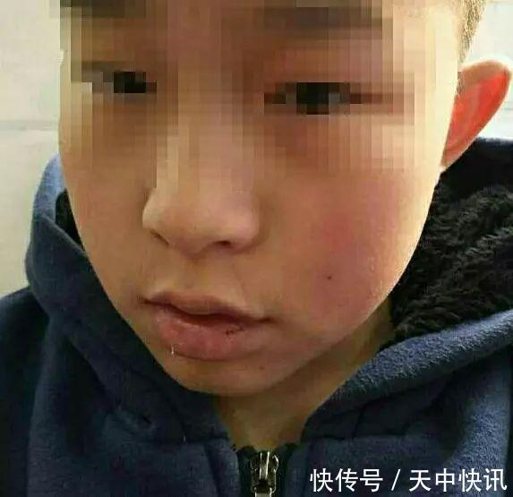 驻马店驿城区一小学生在老师私办辅导班里被打