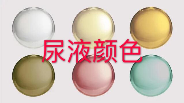 每次都看看!通过尿液“判”健康 这些颜色气味说明“有问题” 每次都看看!通过尿液“判”健康 这些颜色气味说明“有问题”