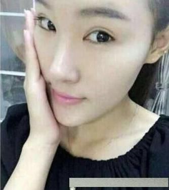 脸上老年斑不要怕,药店有一种医用乳膏,祛斑