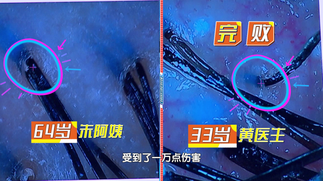 s8怎么保养【我是大医生】头皮保养 年轻的“头等”秘诀！_北京时间_https://www.jmylbn.com_新闻资讯_第4张