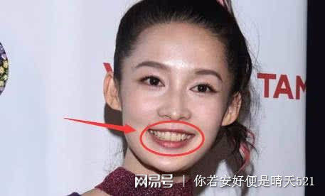 王源不笑则已一笑吓人,牙齿黄的和李沁有一拼