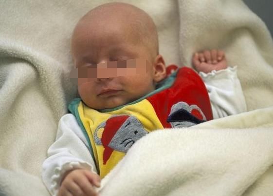 宝宝深夜发高烧,婆婆使用土方法退烧,第2天送