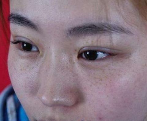 醋配上它竟然可以快速祛斑?睡前涂一涂,斑点全不见