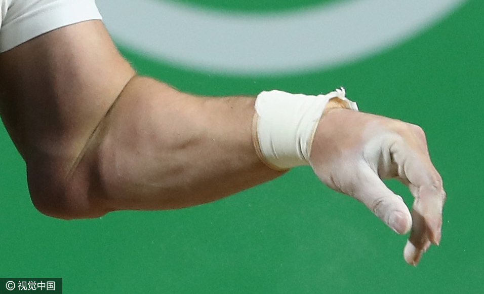 卡拉佩特扬受伤瞬间，胳膊脱臼变形