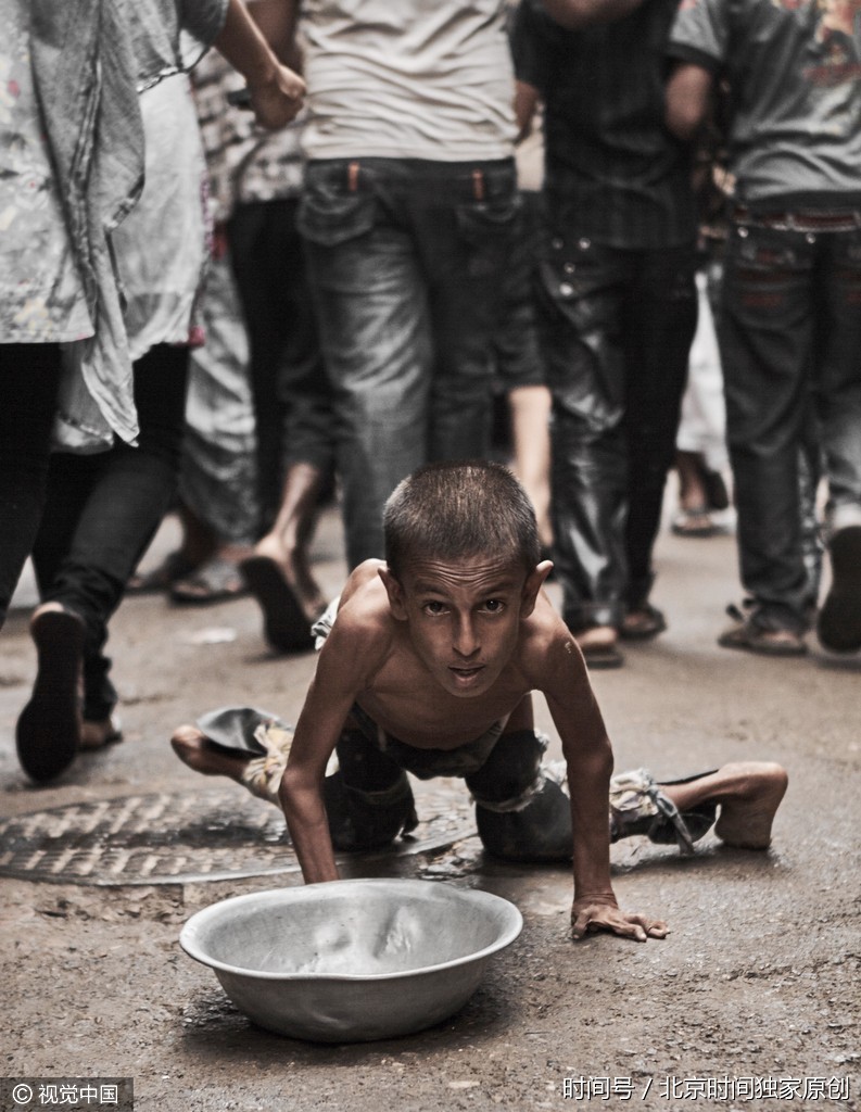 令人揪心!这里的儿童枯瘦如柴 在生死线上挣扎谋生