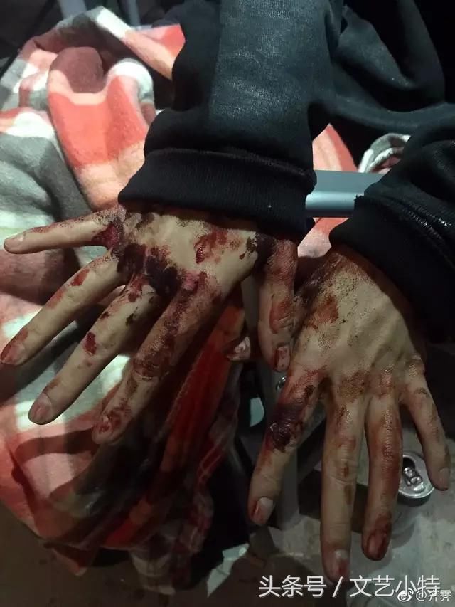 小鲜肉手指划伤就是敬业?再看看人家国外明星
