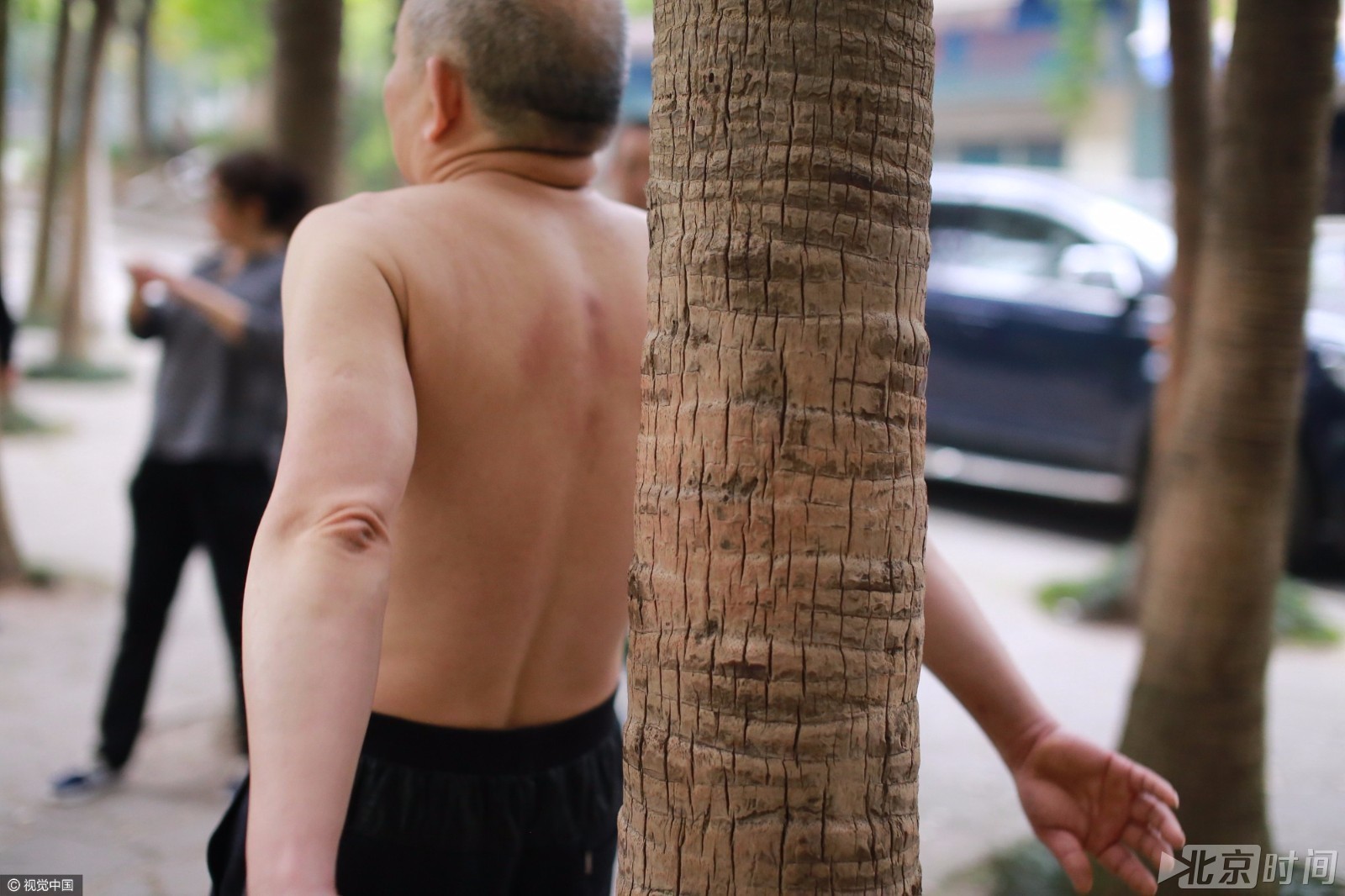 重庆大爷大妈“哐哐哐”撞树“树疗” 重庆大爷大妈“哐哐哐”撞树“树疗”