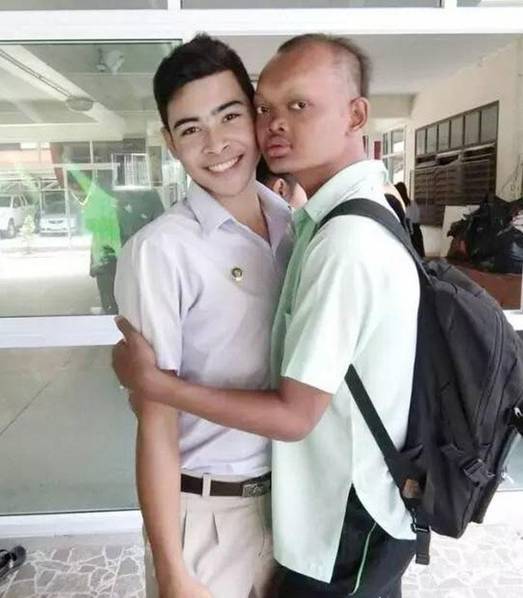 泰国最丑的模特 如今逆袭成家喻户晓明星