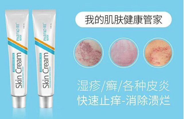 鼻子脂溢性皮炎是什么?治疗还是需要这几招