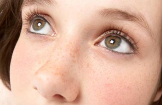 黄褐斑越深说明黑色素堆积越多,3招轻松消除黑