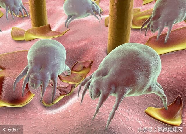 螨虫,是导致鼻炎的魔鬼,要杀灭它靠这种不起