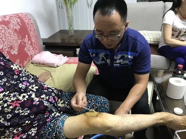 火药传人朱铁山:18年免费治疗烧烫伤者逾千