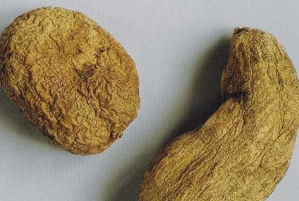 咽炎妙方吃了1次见效,治愈咽炎再也没复发过!