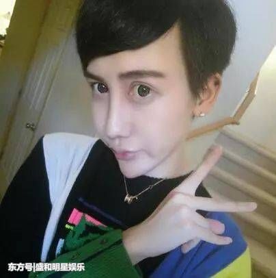 盘点整容失败的明星,网友感叹:那张水灵灵的脸蛋,可惜了!